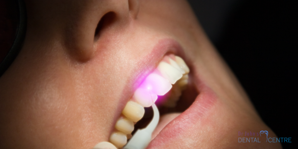 Dr Johns Dental Centre Trivandrum Lasers