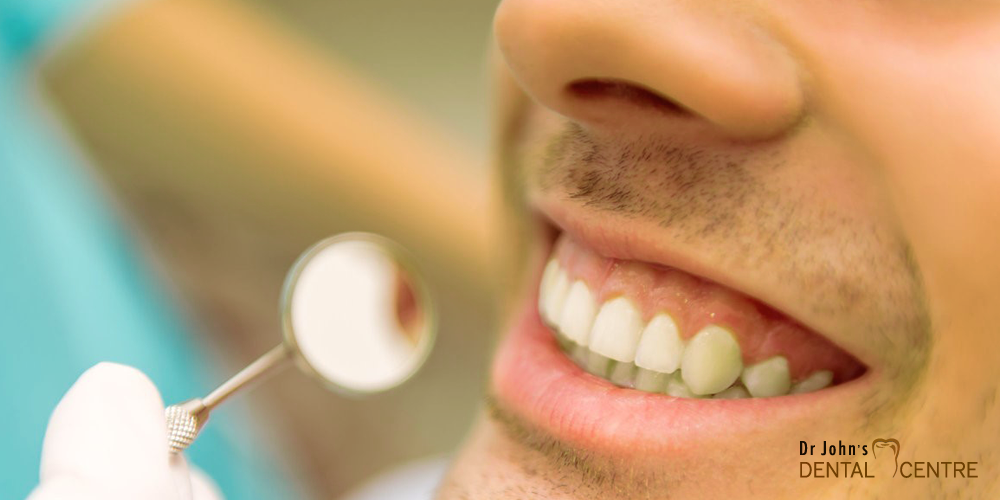 Dr Johns Dental Centre Trivandrum Full Mouth Rehabilitation
